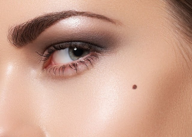 Q&A Series #4 Q: Can I remove my moles using laser?