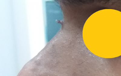 Q&A Series #12 Q: Help! I am growing horn on my nose!
