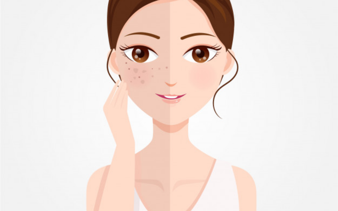 Q&A Series #23 Q: I have heard that Heliocare Fern Plus is effective in making the skin tone fairer in normal people. But is it effective on pigmentation/ spots on my face?