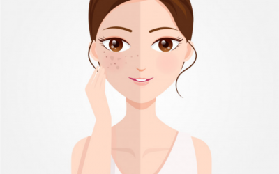 Q&A Series #23 Q: I have heard that Heliocare Fern Plus is effective in making the skin tone fairer in normal people. But is it effective on pigmentation/ spots on my face?